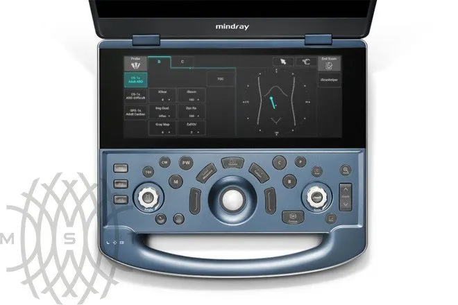 УЗИ аппарат Mindray MX7 Exp портативный