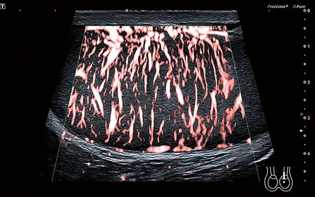 Клинические изображения Canon (Toshiba) Aplio i800 аппарат УЗИ