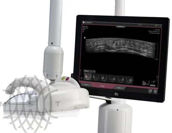 GE HealthCare Invenia ABUS ультразвуковая система
