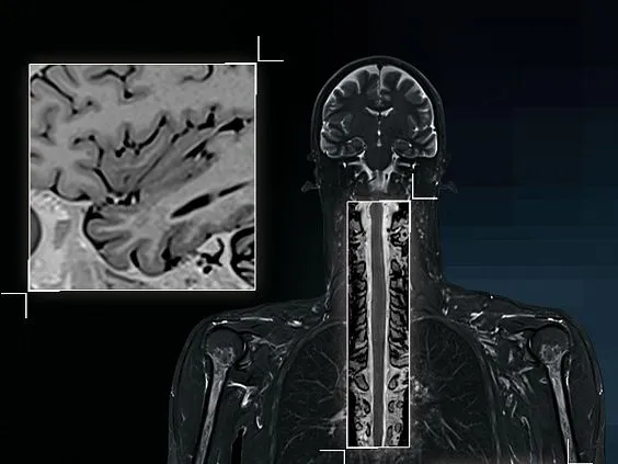 Клинические изображения Магнитно-резонансный томограф Siemens MAGNETOM Prisma 3T