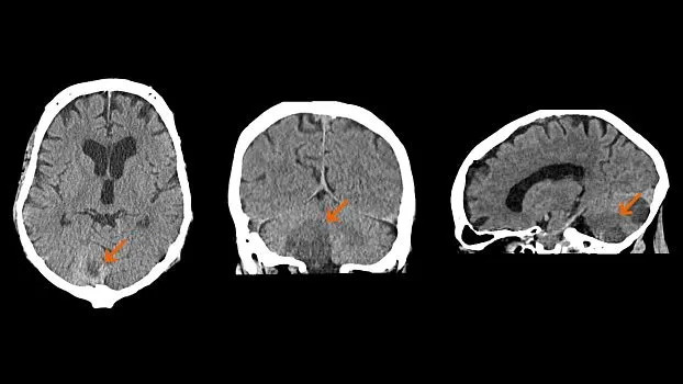 Клинические изображения Siemens SOMATOM go.Up компьютерный томограф