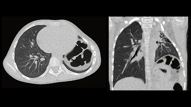Клинические изображения Siemens SOMATOM go.Up компьютерный томограф