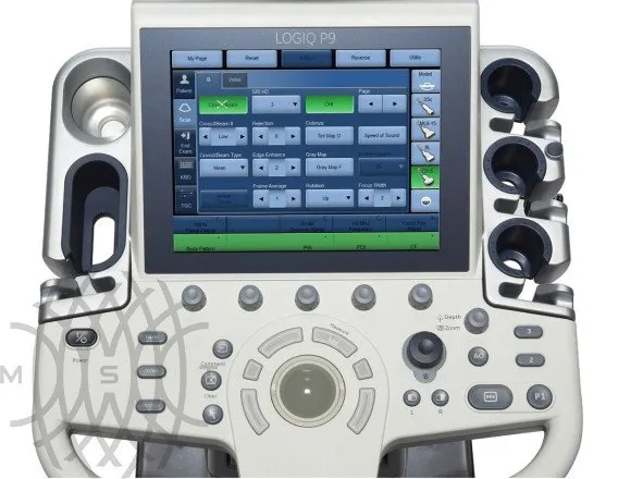 GE Logiq P9 ультразвуковая диагностическая система