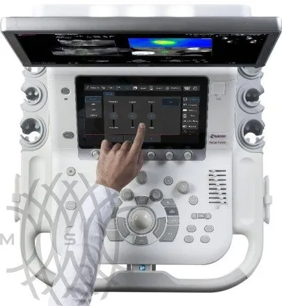 УЗИ аппарат Esaote MyLab 9