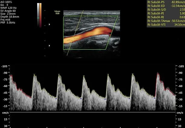 Клинические изображения УЗИ аппарат GE HealthCare Voluson S10