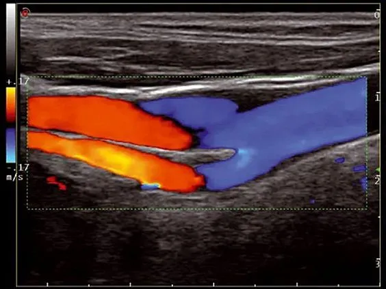 Клинические изображения УЗИ аппарат Esaote MyLab Twice
