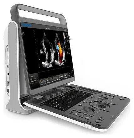 Портативный УЗИ аппарат Chison SonoTouch 60 Pro Портативный УЗИ аппарат Chison SonoTouch 60 Pro