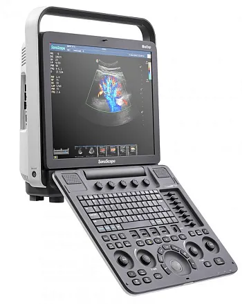 Sonoscape S8 Exp ультразвуковой аппарат Sonoscape S8 Exp ультразвуковой аппарат
