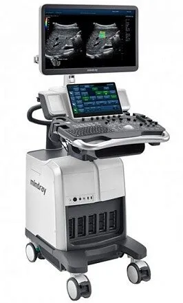 УЗИ аппарат Mindray DC-80 Exp УЗИ аппарат Mindray DC-80 Exp
