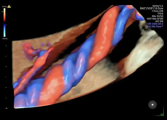 Клинические изображения Ультразвуковая диагностическая система GE HealthCare Voluson E6