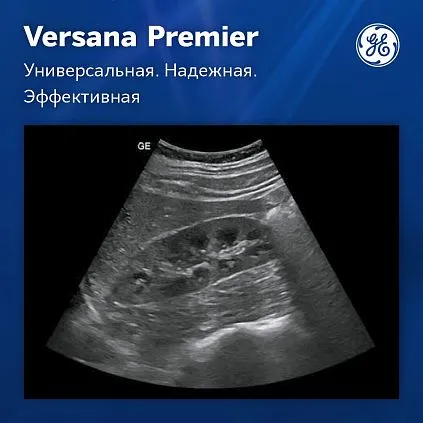 Клинические изображения Versana Premier Black GE Healthcare