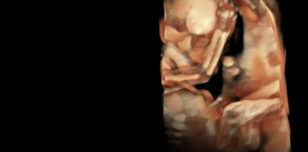 Клинические изображения УЗИ аппарат GE HealthCare Voluson Expert 20