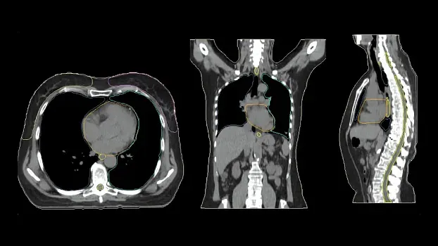 Клинические изображения Siemens SOMATOM go.Sim компьютерный томограф