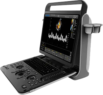УЗИ аппарат Chison Sonotouch 60 OB портативный