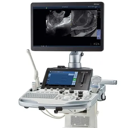 GE Logiq S8 XDclear ультразвуковая диагностическая система  GE Logiq S8 XDclear ультразвуковая диагностическая система