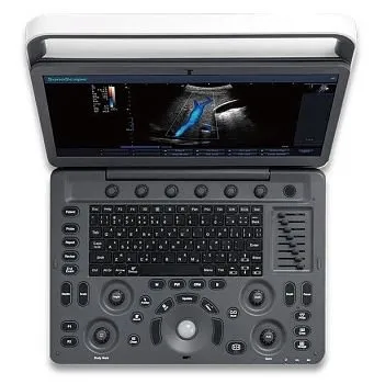 Sonoscape E1 Vet ультразвуковой аппарат