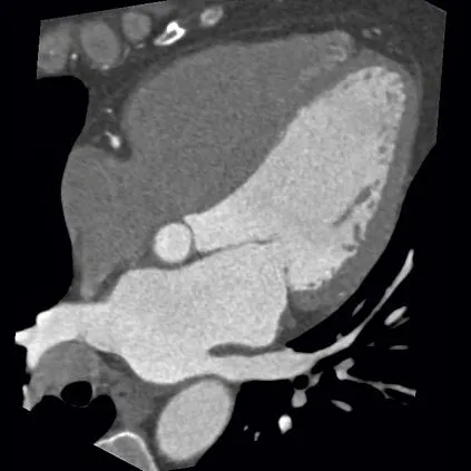 Клинические изображения Siemens SOMATOM go.Top компьютерный томограф