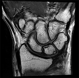 Клинические изображения МРТ аппарат GE SIGNA Premier 3T