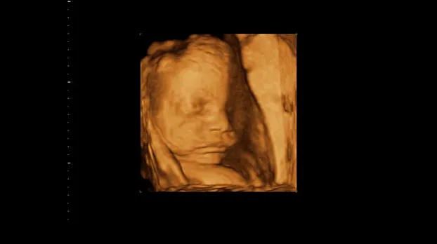 Клинические изображения GE HealthCare Versana Balance УЗИ аппарат