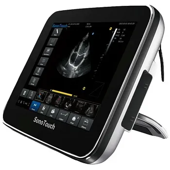 Портативный ультразвуковой аппарат Chison SonoTouch 30