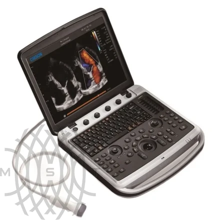 УЗИ аппарат Chison SonoTouch 80 Expert портативный