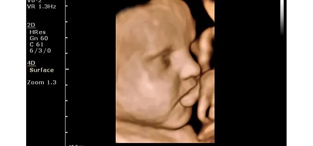 Клинические изображения Philips ClearVue 650 ультразвуковой аппарат