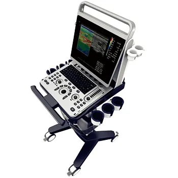 УЗИ аппарат Chison SonoTouch 60 портативный