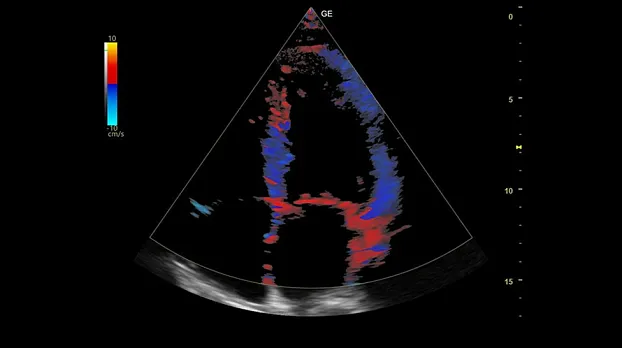 Клинические изображения GE HealthCare Versana Balance УЗИ аппарат