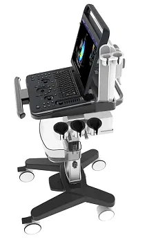 Портативный ультразвуковой аппарат Chison SonoTouch 30