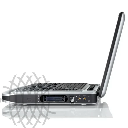 УЗИ аппарат Chison SonoTouch 80 Expert портативный