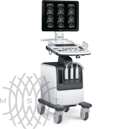 Samsung Medison SonoAce R7 УЗИ аппарат