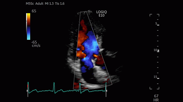 Клинические изображения GE HealthCare Logiq E10 ультразвуковая система