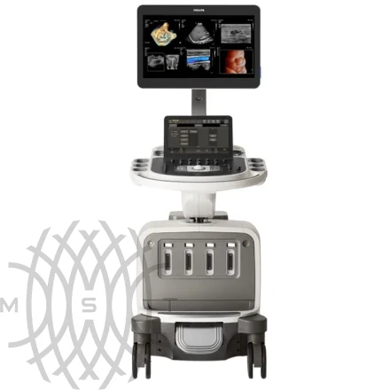 Philips EPIQ Elite ультразвуковой аппарат