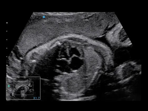 Клинические изображения Аппарат УЗИ SIUI Apogee 5500