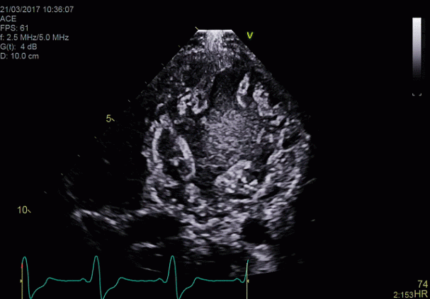 Клинические изображения УЗИ аппарат GE HealthCareVivid E90