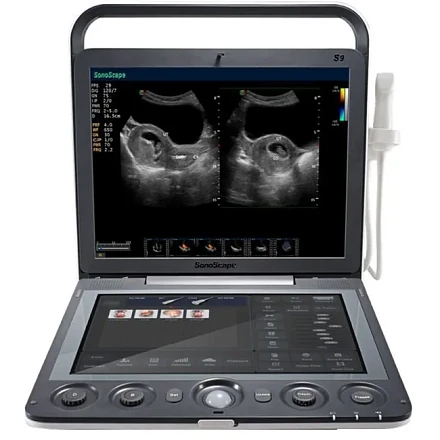 Sonoscape S9 ультразвуковой аппарат Sonoscape S9 ультразвуковой аппарат