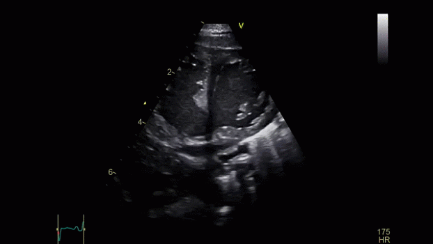 Клинические изображения Ультразвуковая диагностическая система GE HealthCare Vivid iQ портативная
