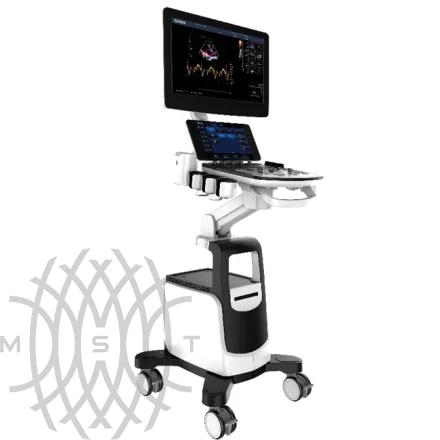 УЗИ аппарат Chison Qbit 9 New Matrix