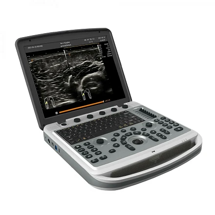 УЗИ аппарат Chison SonoTouch 80 Pro портативный УЗИ аппарат Chison SonoTouch 80 Pro портативный