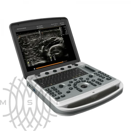 УЗИ аппарат Chison SonoTouch 80 Pro портативный