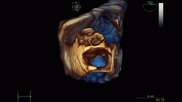 Клинические изображения Ультразвуковая диагностическая система GE HealthCare Vivid iQ портативная