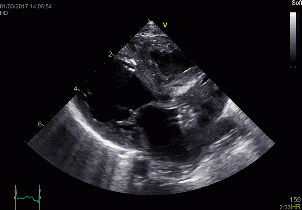 Клинические изображения УЗИ аппарат GE HealthCareVivid E90