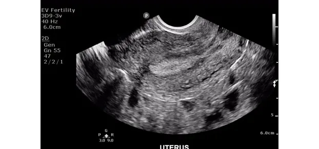 Клинические изображения Philips ClearVue 650 ультразвуковой аппарат