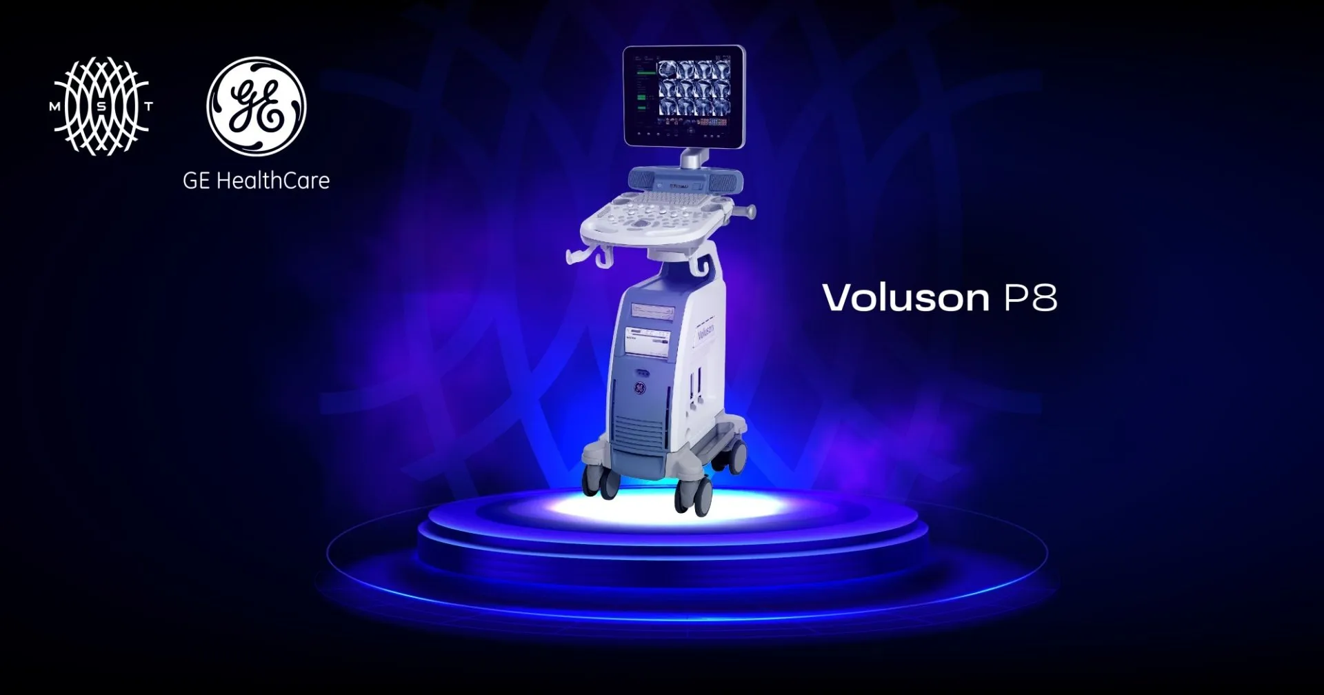 Voluson P8 Voluson P8