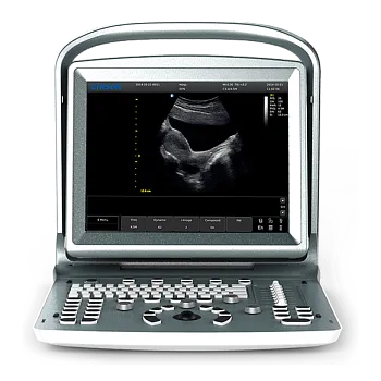 УЗИ аппарат Chison ECO 5