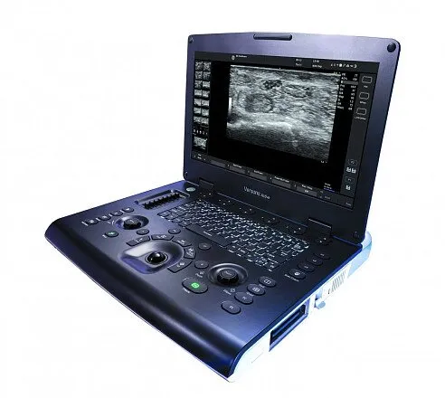 УЗИ аппарат GE Healthcare Versana Active портативный УЗИ аппарат GE Healthcare Versana Active портативный